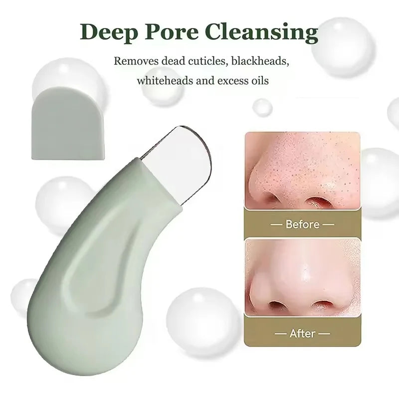 Outil Anti-Points Noirs & Pores | Nettoyant Visage Professionnel | Peau Nette & Purifié