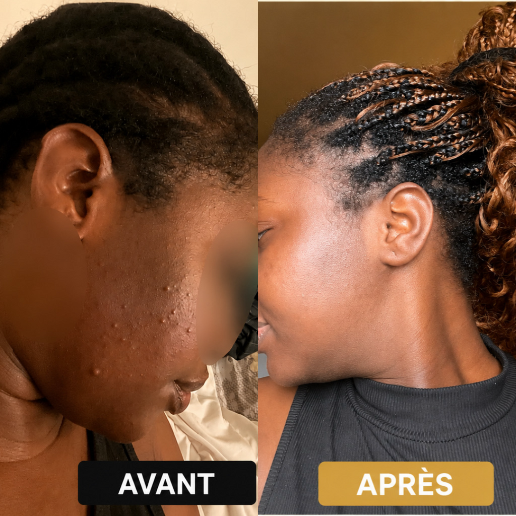Savon Curcuma & Acide Kojique | Éclat & Luminosité | Soin Visage & Corps Naturel