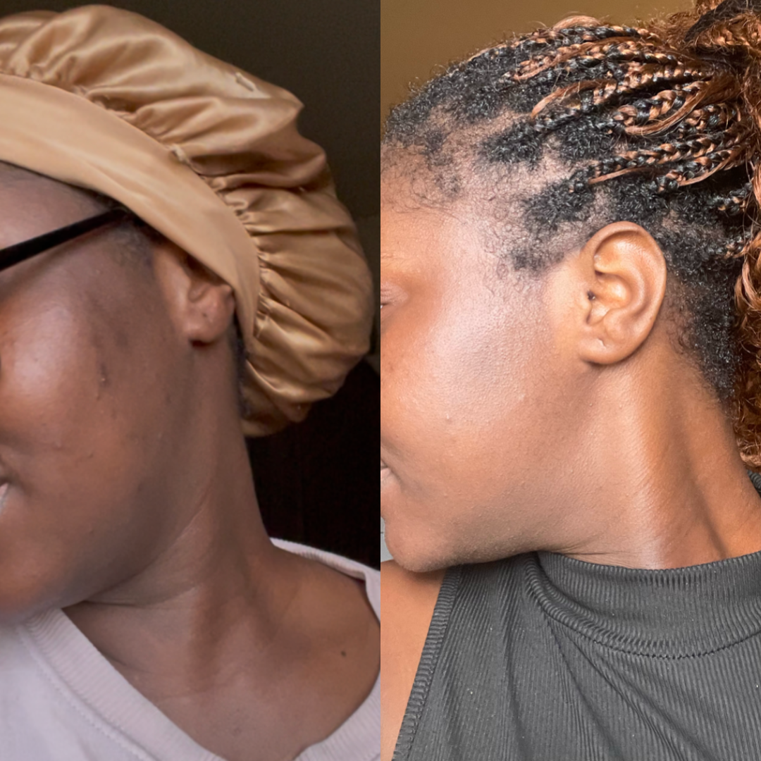 Savon Curcuma & Acide Kojique | Éclat & Luminosité | Soin Visage & Corps Naturel